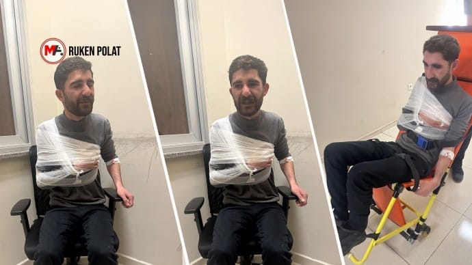 Polis işkencesi: Kürt siyasetçinin omuz ve parmakları kırıldı