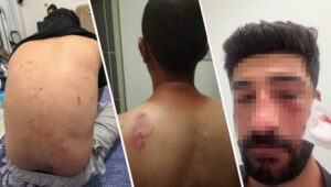 690x390cc-mrs-11-08-2025-mersin-aile-saldiri5 (1)