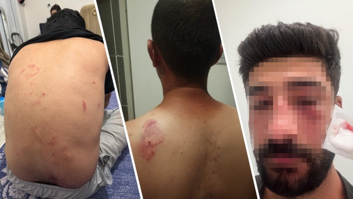690x390cc-mrs-11-08-2025-mersin-aile-saldiri5 (1)